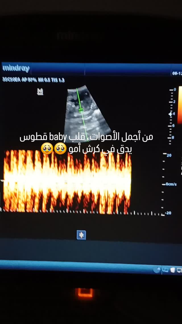 #petstagram #petlovers #catsofinstagram...