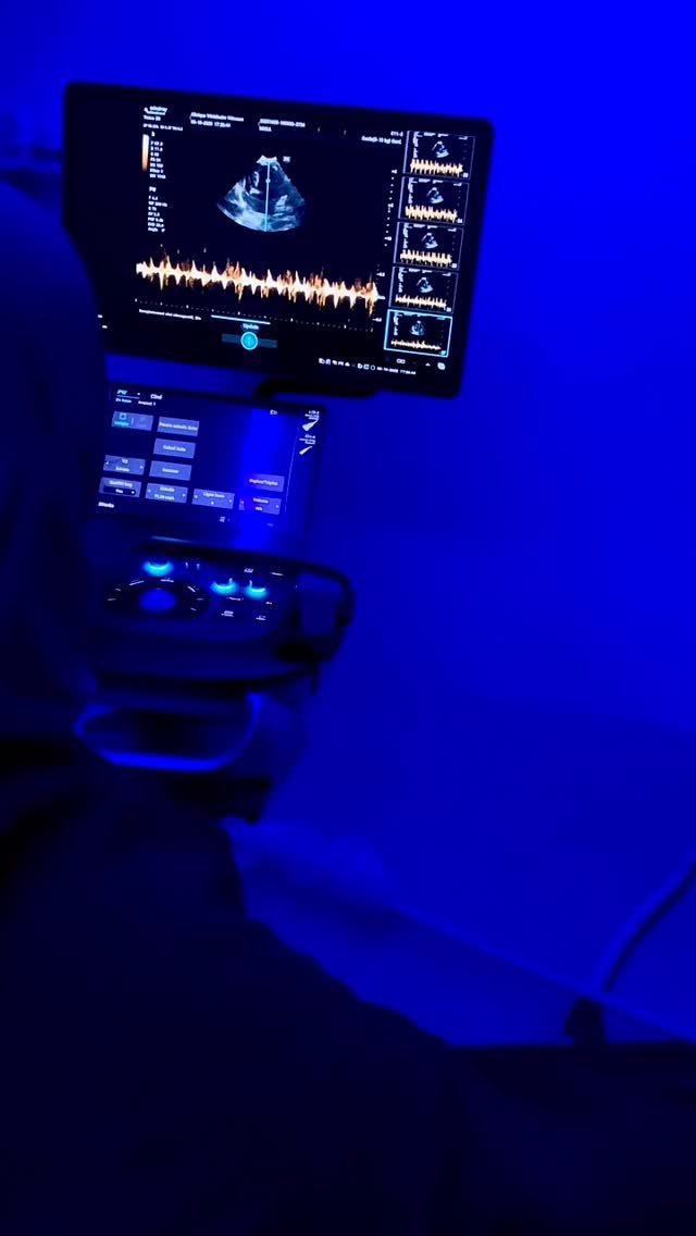 L’échocardiographie, c’est le moyen le p...