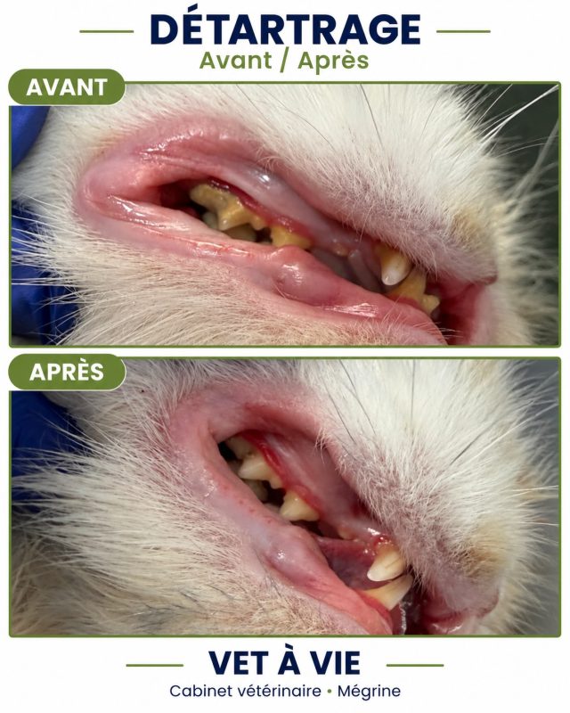🦷✨ Un avant / après qui parle de lui-m...